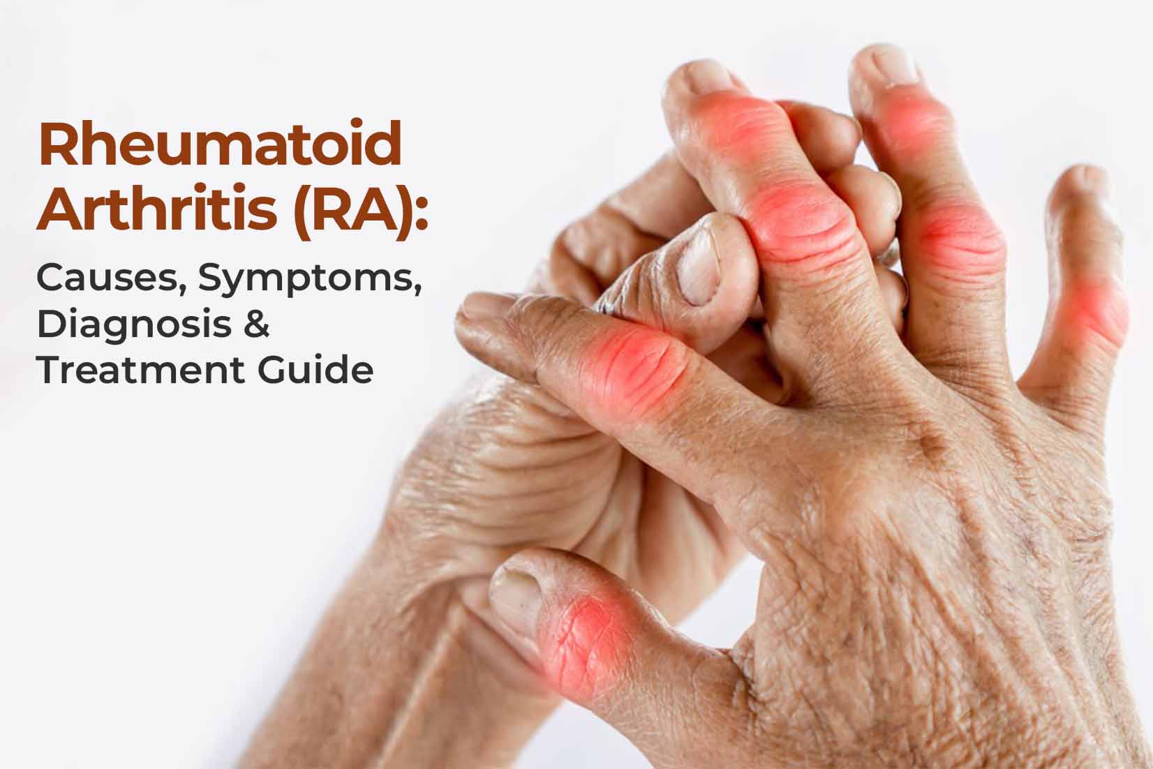Rheumatoid Arthritis