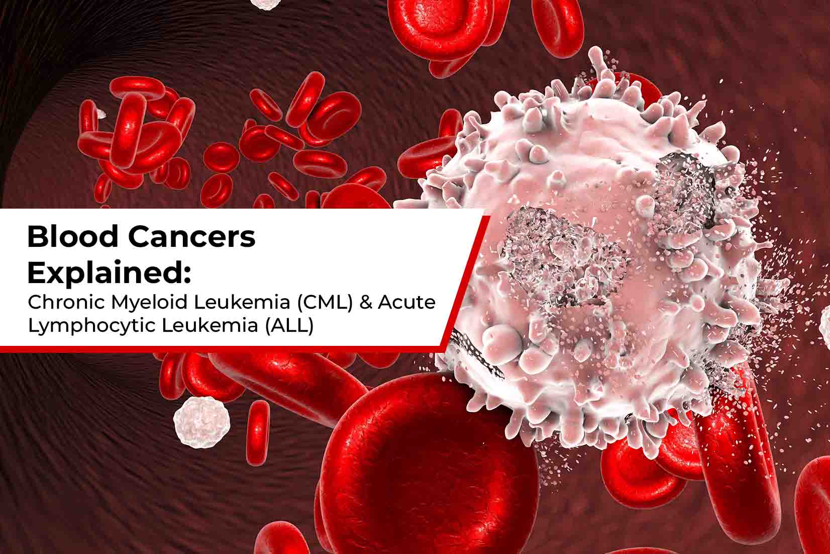 Blood Cancers Explained